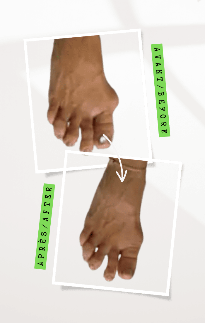 dr peter galati img a podiatrist fort lauderdale florida (2)